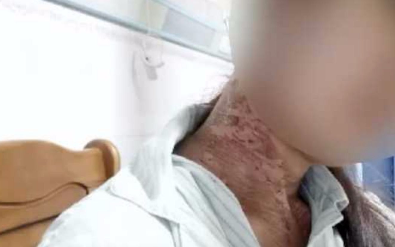 封面无法加载